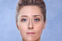 Fotolia
