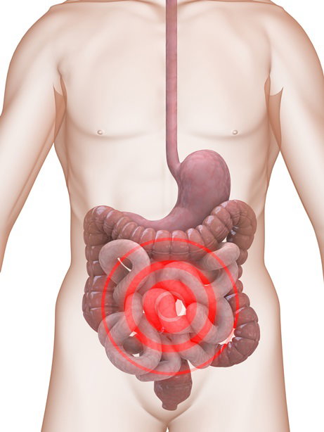 Fotolia