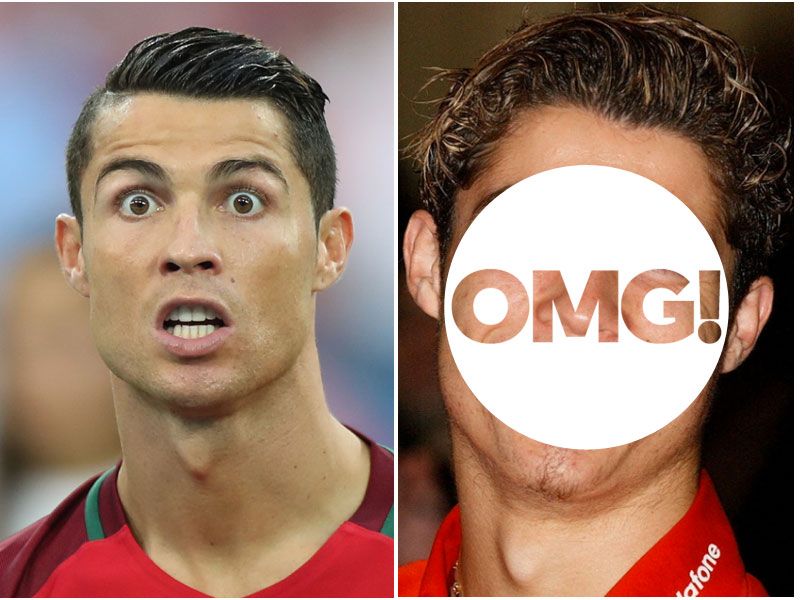 Cristiano Ronaldo kiedyś, Ronaldo w przeszłości, Euro 2016 Portugalia Walia