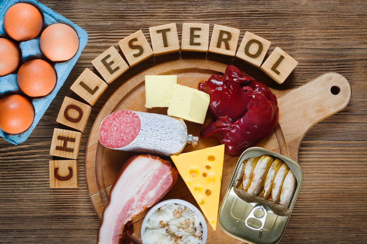 cholesterol LDL