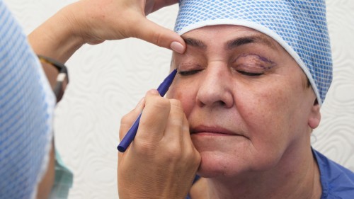 skin-clinic-plastyka-powiek-2456582-4f2da17