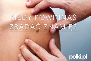 Kiedy zbadać znamię - 5 ważnych objawów czerniaka