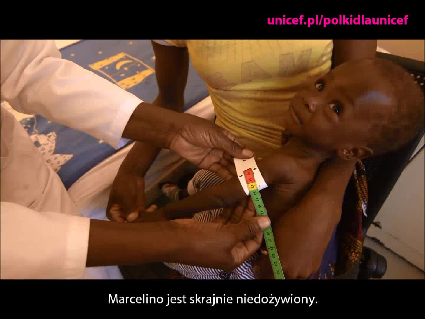 Pomoc niedożywionym dzieciom w Afryce - video UNICEF