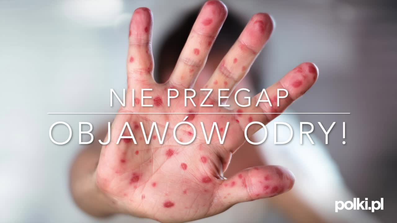 Objawy odry we wczesnej i późnej fazie zakażenia