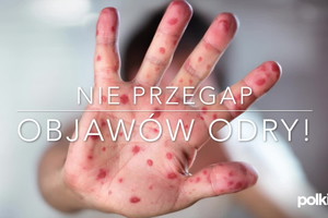 Objawy odry we wczesnej i późnej fazie zakażenia