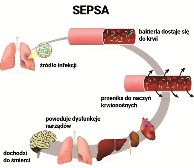 sepsa-2438699-0152913