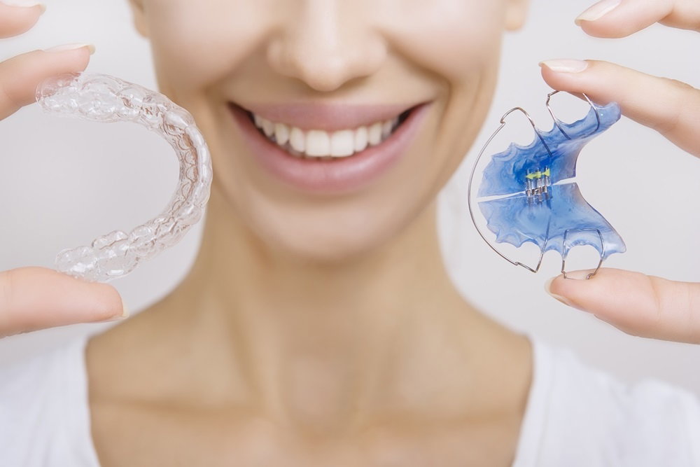Aparaty ortodontyczne
