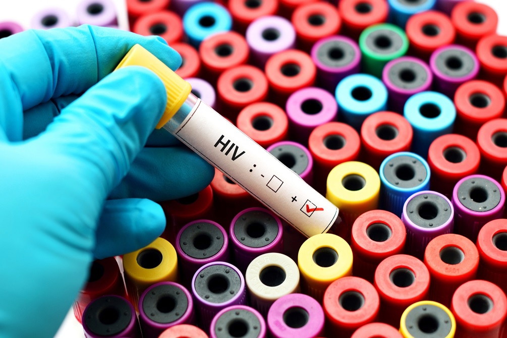 hiv