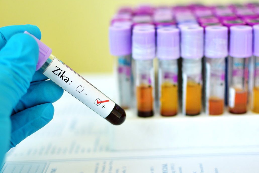 zika