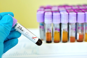 zika