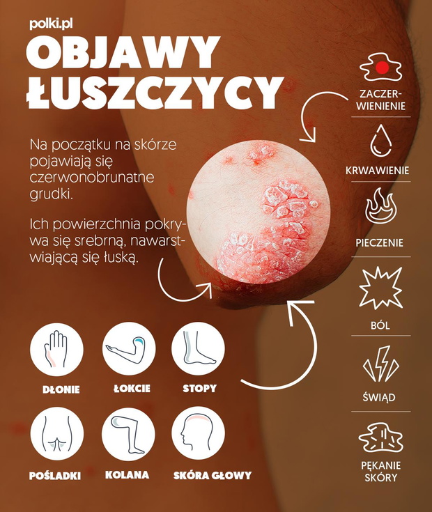 luszczyca-2438653-199961c
