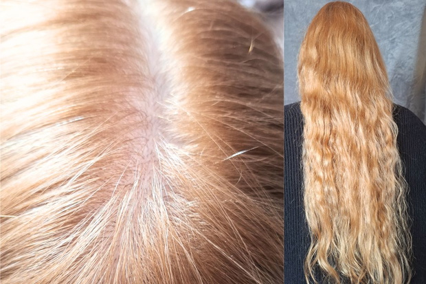 Włosy po stosowaniu linii Beaver Anti Hair Loss