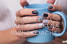 Białe plamki na paznokciach - przyczyny i sposoby leczenia