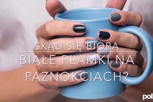 Białe plamki na paznokciach - przyczyny i sposoby leczenia