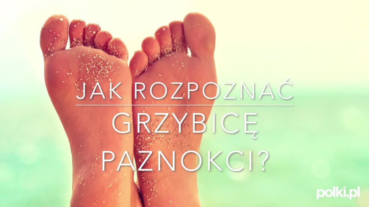 Objawy grzybicy paznokci - zobacz wideo