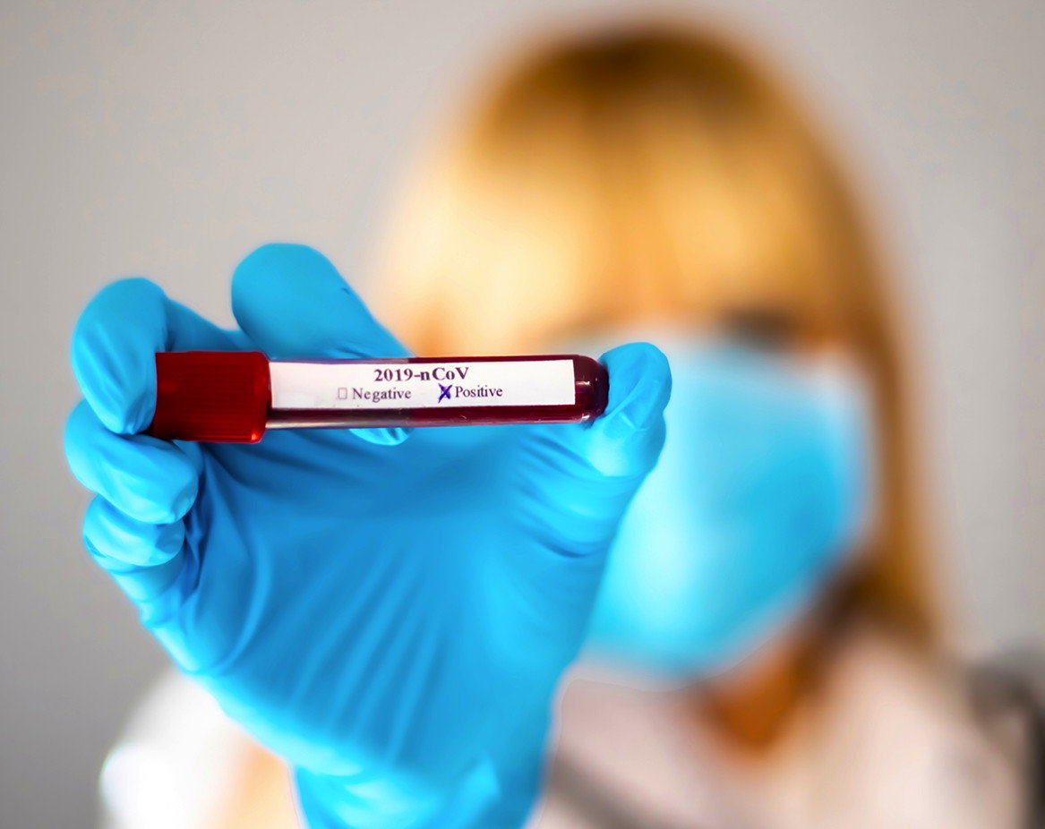Koronawirus, test, covid, pandemia, epidemia