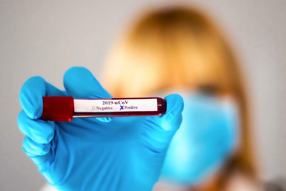 Koronawirus, test, covid, pandemia, epidemia