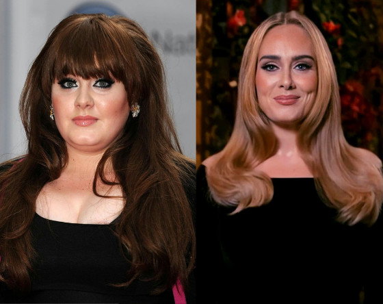 adele-operacje-plastyczne