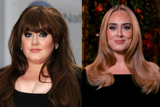 adele-operacje-plastyczne