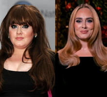 adele-operacje-plastyczne
