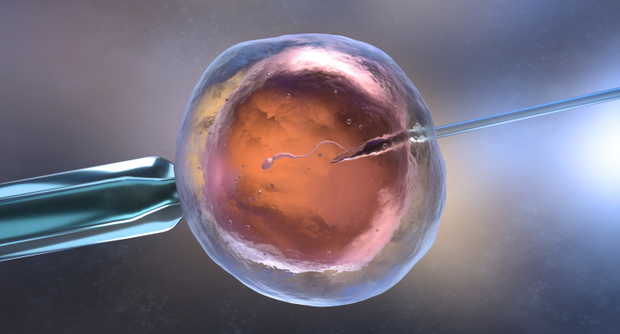 Artificial insemination or in vitro fertilization