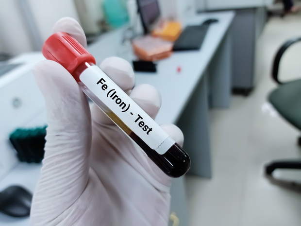 Biochemist of doctor holds blood sample for Transferrin test. Ir