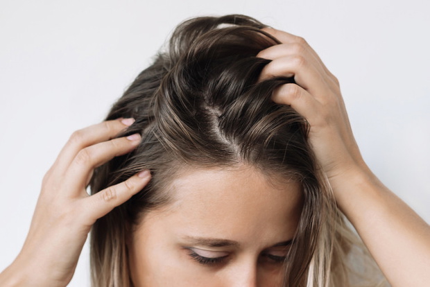 Young woman with dirty greasy hair. The problem of oily scalp. Itching of the head