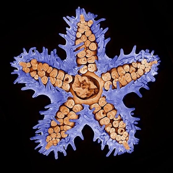 315048-GALLERY600-5c321e9