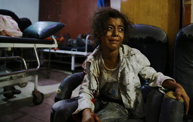 abd-doumany-doumas-children-syria-2015-338554-GALLERYBIG-65d0760