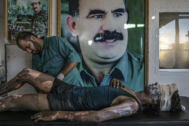 mauricio-lima-is-fighter-treated-at-kurdish-hospital-brazil-2015-338586-GALLERYBIG-c20eda8