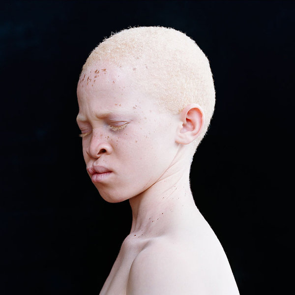 zdjecia-albinosow-393652-GALLERY600-aaf3157