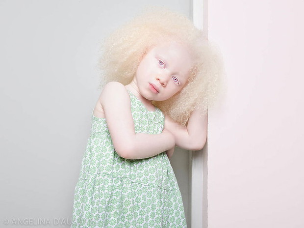 zdjecia-albinosow-393653-GALLERYBIG-aca7df5