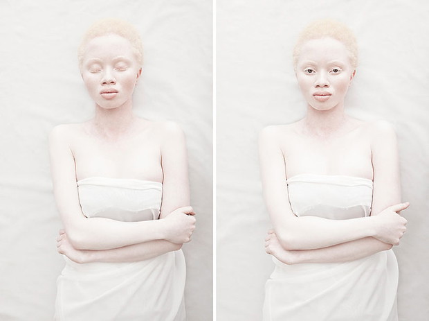 zdjecia-albinosow-393654-GALLERYBIG-4c225ca