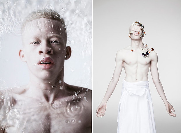 zdjecia-albinosow-393656-GALLERYBIG-f0f132c