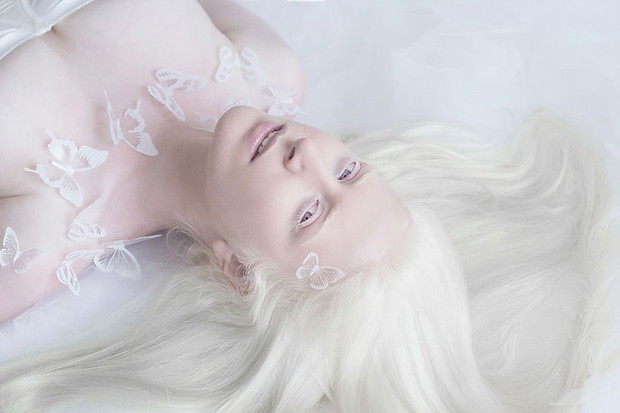 zdjecia-albinosow-393657-GALLERYBIG-ebeb6c5