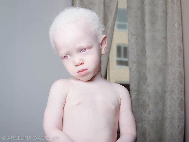zdjecia-albinosow-393658-GALLERYBIG-1fa2e4a