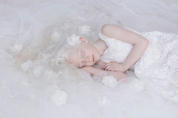 zdjecia-albinosow-393663-GALLERYBIG-65902da