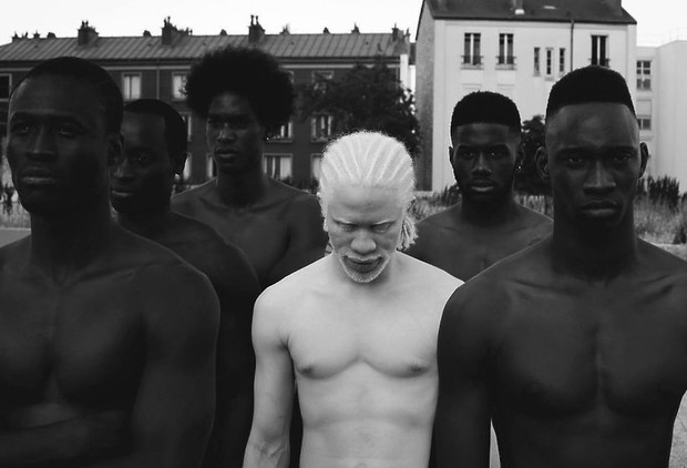 zdjecia-albinosow-393665-GALLERYBIG-423a16e
