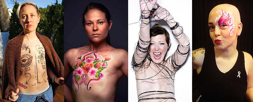 Living Without Breasts, New York Times,