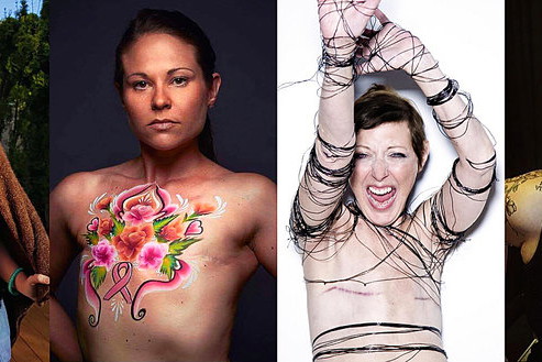 Living Without Breasts, New York Times,