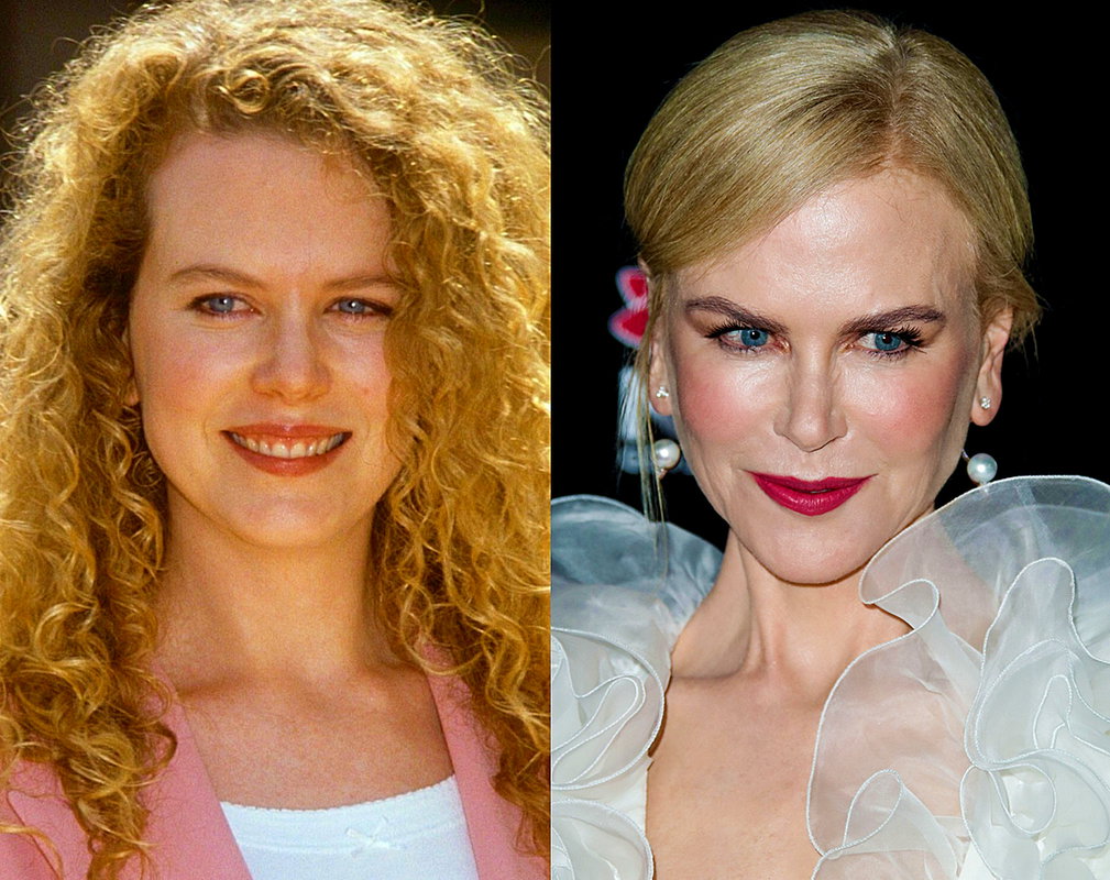 Nicole Kidman - metamorfoza