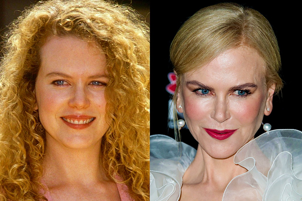 Nicole Kidman - metamorfoza