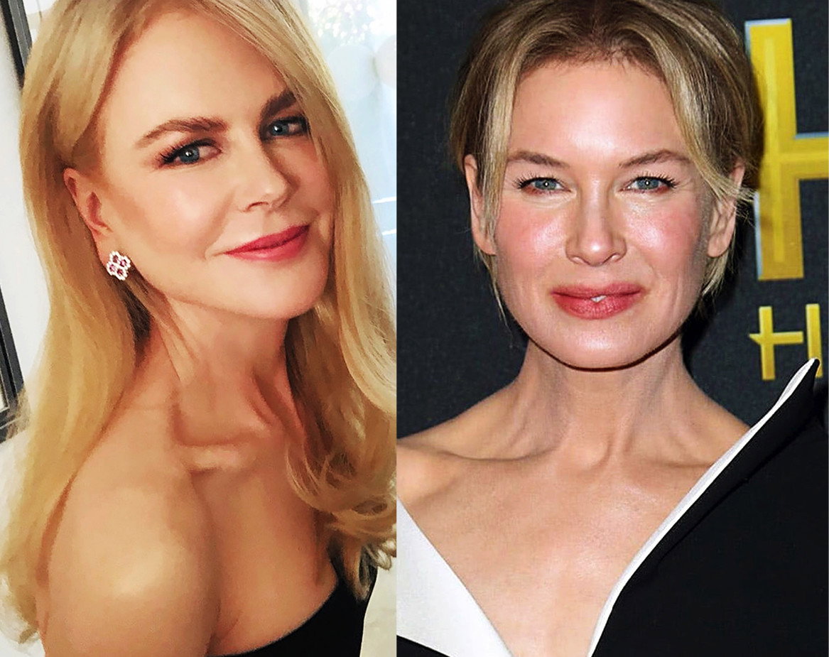 ofiary-botoksu-kidman-zellweger-ryan