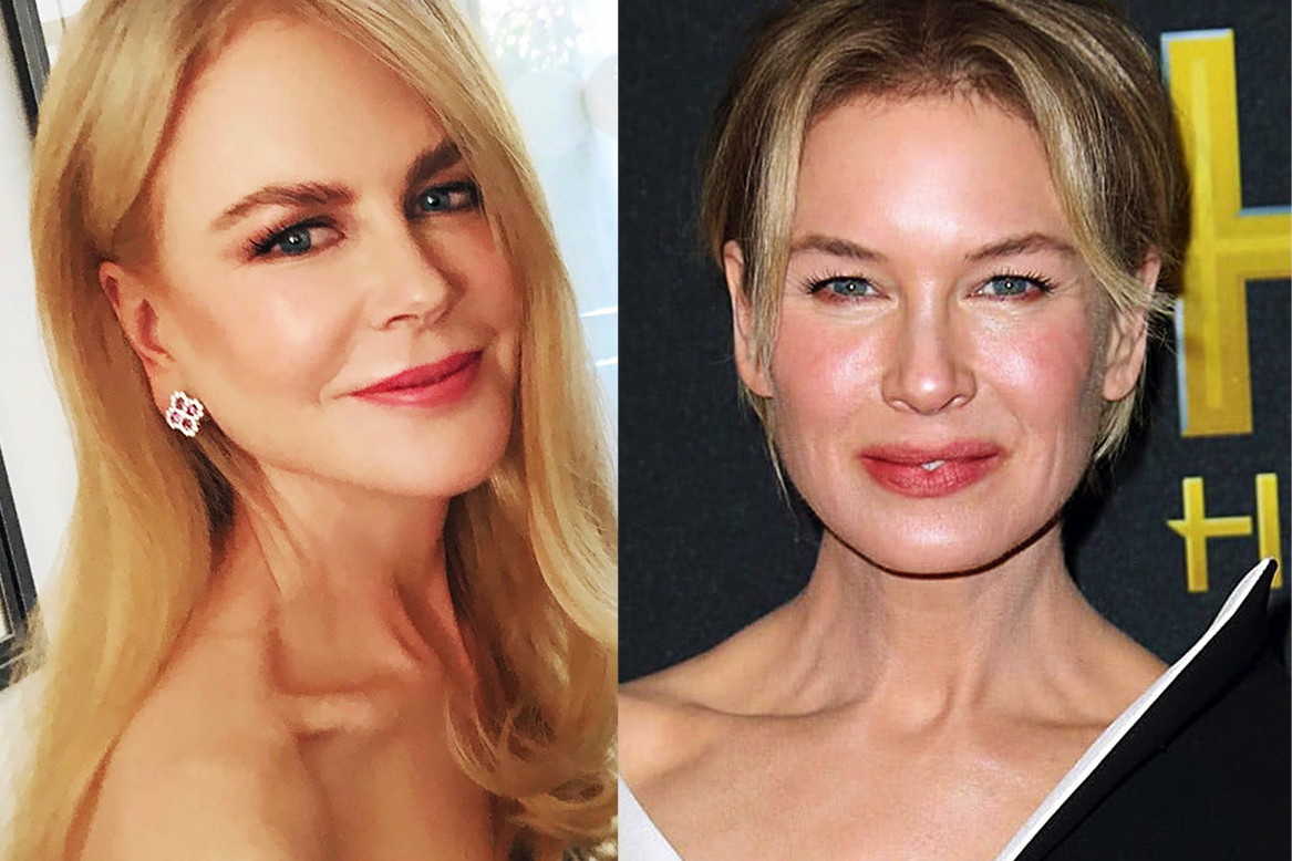 ofiary-botoksu-kidman-zellweger-ryan