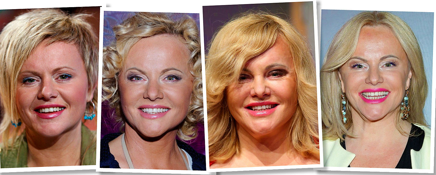 Joanna Kurowska, metamorfoza Joanny Kurowskiej, zabiegi medycyny estetycznej Joanny Kurowskiej