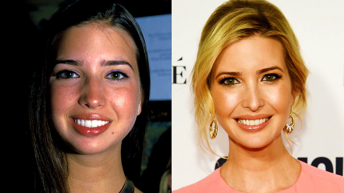 Ivanka Trump, metamorfoza twarzy, MAIN TOPIC