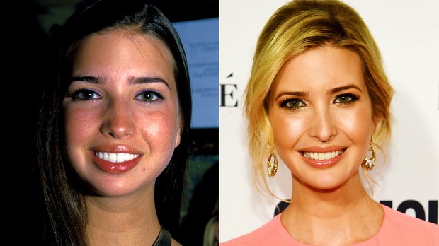 Ivanka Trump, metamorfoza twarzy, MAIN TOPIC