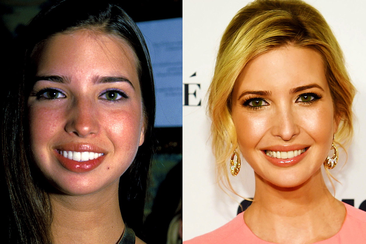 Ivanka Trump, metamorfoza twarzy, MAIN TOPIC