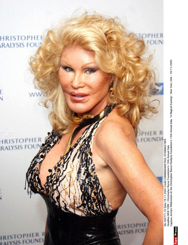 Jocelyn Wildenstein