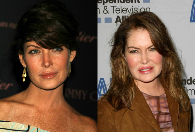 Lara Flynn Boyle, ofiary botoksu